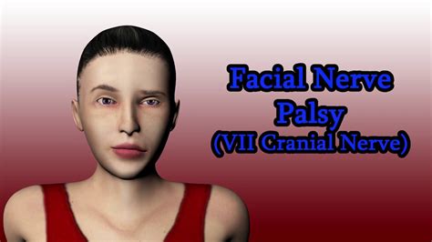 Facial Nerve Palsy Vii Cranial Nerve Examination Medical Animation