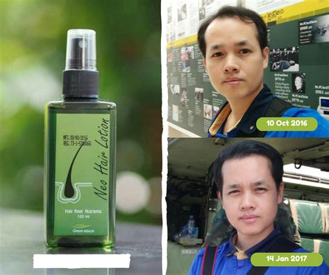 The best conditioner for curly hair. Neo Hair Lotion by Green Wealth - Thailand Best Selling ...