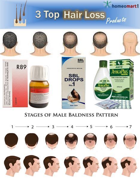 Natural Hair Loss Treatment For Men And Women At Home Artofit