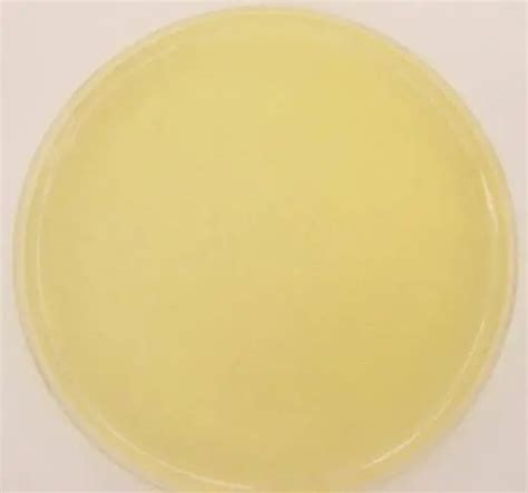 Nutrient Agar Composition Preparation And Uses Microbeonline