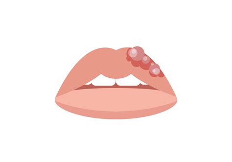 Swelling Of Lips Causes Symptoms And Treatment