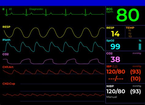 How To Read A Patient Monitor Numbers And Lines Explained