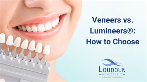 veneers vs lumineers® how to choose