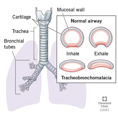 Trachea Anatomy Structure Function And Labeled Diagram Getbodysmart