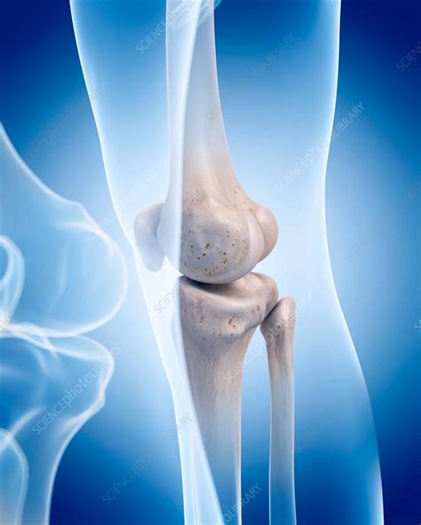 Human Knee Bones Stock Image F0162897 Science Photo Library