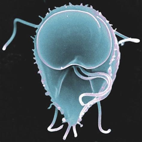 Six Human Parasites You Definitely Dont Want To Host