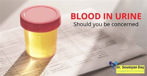 Blood In Urine Know The Causes And Solutions Hematuria Treatment In India