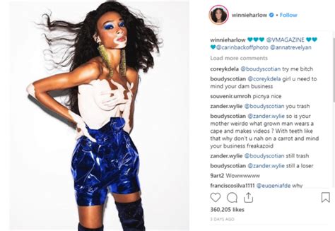 Winnie Harlow Has Divine Comeback For Snarky Comment About Her Vitiligo Condition