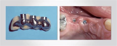 .(horizontal = bad) group function: 3 New Occlusion Courses from Dr. Frank Spear - Spear Education