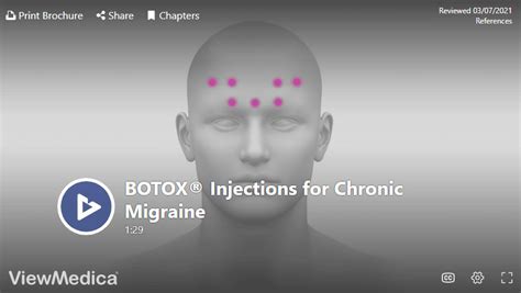 Botox For Migraines In Knoxville Tn Omega Pain Management