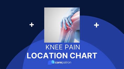 Knee Pain Chart Youtube