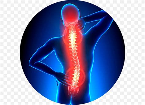 Vertebral Column Back Pain Neck Pain Physical Therapy Spinal Stenosis