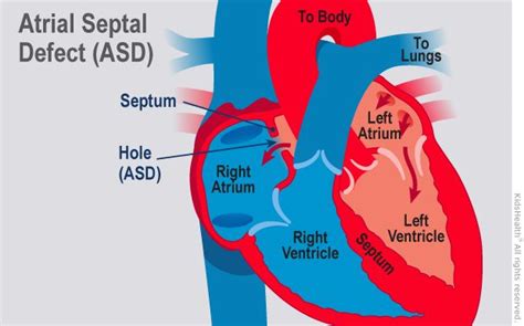 An Image Of The Heart With Labels On It And Other Parts Labeled In Red