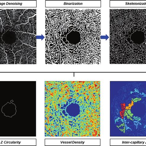 Quantification Of Retinal Microvasculature From Oct Angiography Octa