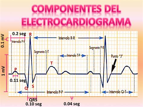 Fisiología humana Componentes de un electrocardiograma