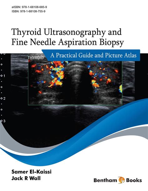 Thyroid Ultrasonography And Fine Needle Aspiration Biopsy A Practical