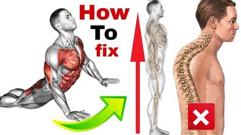 How To Fix An Arched BackBack Arch Exercises YouTube