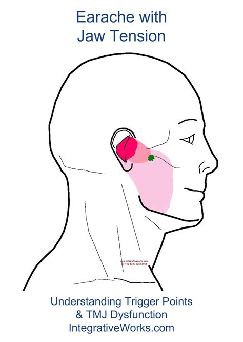 Understanding Trigger Points Earache With Jaw Tension Reflexology