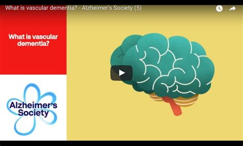 Explaining Vascular Dementia Alzheimers News Today
