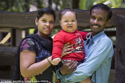 Overweight Toddler In India For Hormone Treatment After