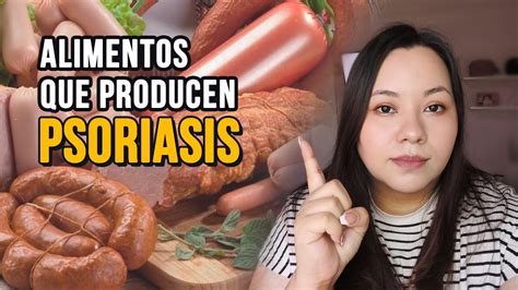 Alimentos Que Si Producen Psoriasis Evitalos Youtube