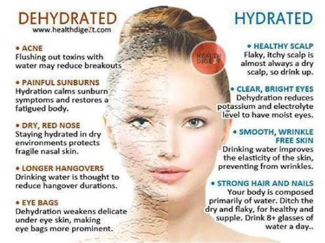 Dehydrated Vs Hydrated