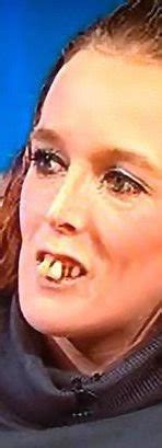 Check Out Pics Of The Teeth That Caused Twitter Meltdown In The Uk Myehaven