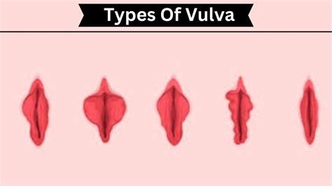 Types Of Vulva And Its Function Youtube