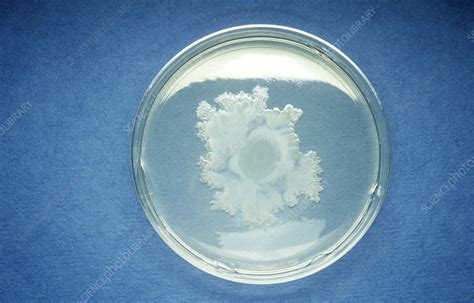 Bacillus Cereus Stock Image C0129435 Science Photo Library