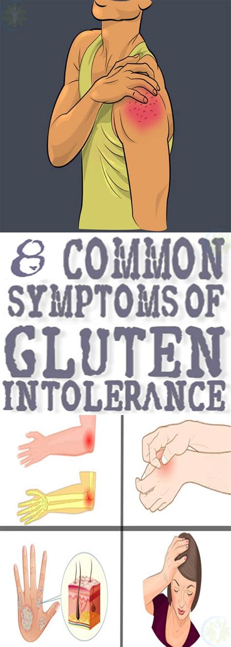 The Most Common Signs Of Gluten Intolerance Lizy Style