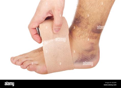 Man With Sprained Ankle Stock Photo Alamy