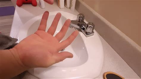 how to stop sweaty hands while gaming aka hyperhidrosis youtube