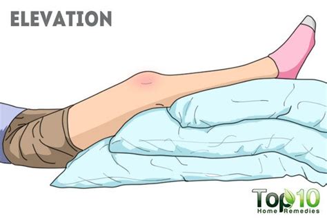 How high should i elevate my foot? Home Remedies for Swelling from an Injury | Top 10 Home ...