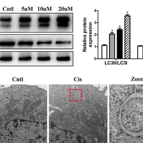 Effect Of Autophagy Inducer On Cisplatin Induced Mitophagy HK Cells