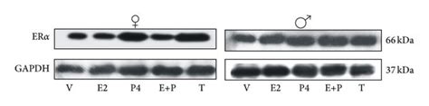 regulation of erα protein content by sex hormones in airway smooth download scientific diagram