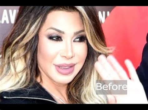 تحميل اغاني نوال الزغبي وتحميل البوم نوال الزغبي الجديد من سمعنا. ‫شاهدوا نوال الزغبي بعد سحب الفيلر من وجهها! وماذا قالت عن ...