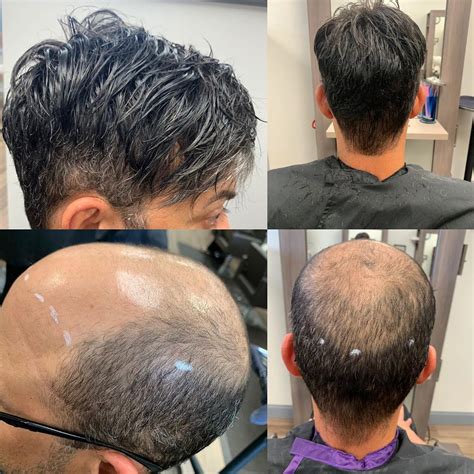 How Does The Mens Toupee Sale Before And After