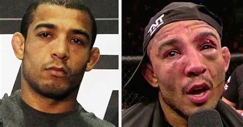14 Of The Most Brutal Before And After Pics Of Ufc Fighters Ouch Gallery Ebaums World
