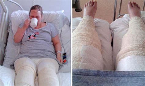 Graphic Content Mother Nearly Loses Her Legs After Bikini Shave Causes