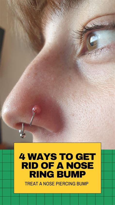 4 things to treat infected nose piercing bump without closing it in 2021 nose piercing bump