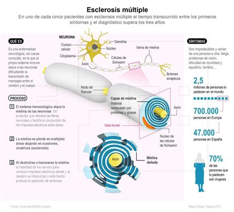 La creencia más frecuente es que es causada por virus, un defecto genético o ambos. El número de pacientes con esclerosis múltiple se ha ...