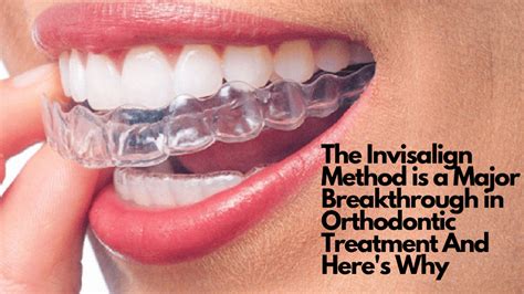 The Invisalign Method Is A Major Breakthrough In Orthodontic Treatment