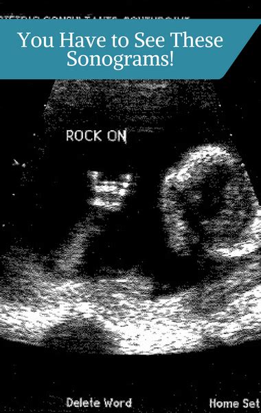 Dr Oz Ultrasound Shows Baby Give Peace Sign Rock Horns