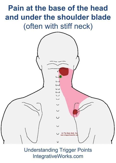 Pin On Pain Back Of Neck