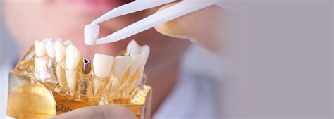 Family General Dentist Sterling VA 20165 | Sterling VA Dentist Near Me