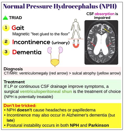 Normal Pressure Hydrocephalus Nph Medicine Keys For Mrcps