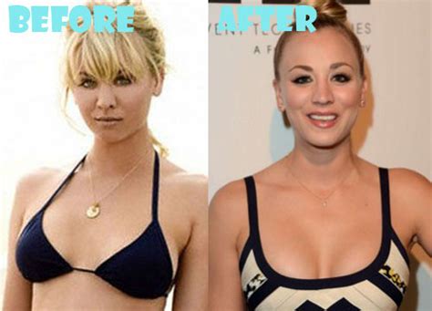 Kaley Cuoco Plastic Surgery Before And After Boob Job Lovely Surgery