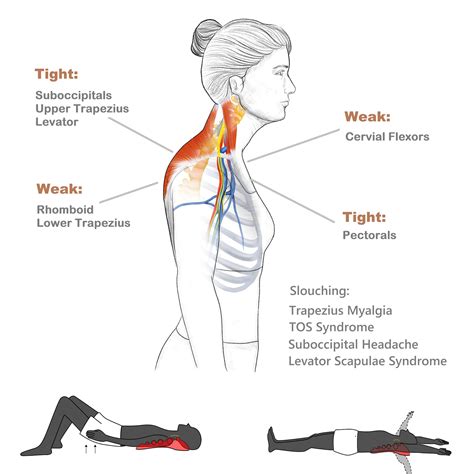 Levator Scapulae Muscle Stretch Ubicaciondepersonascdmxgobmx