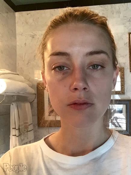 Amber Heard And Johnny Depp Photos Show Alleged Domestic