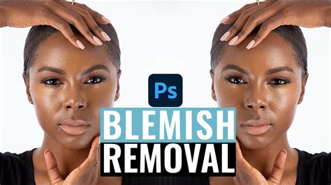 Blemish Removal Skin Retouching Photoshop Tutorial Youtube